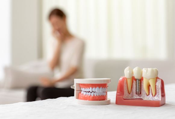 임플란트-시술과정-가격