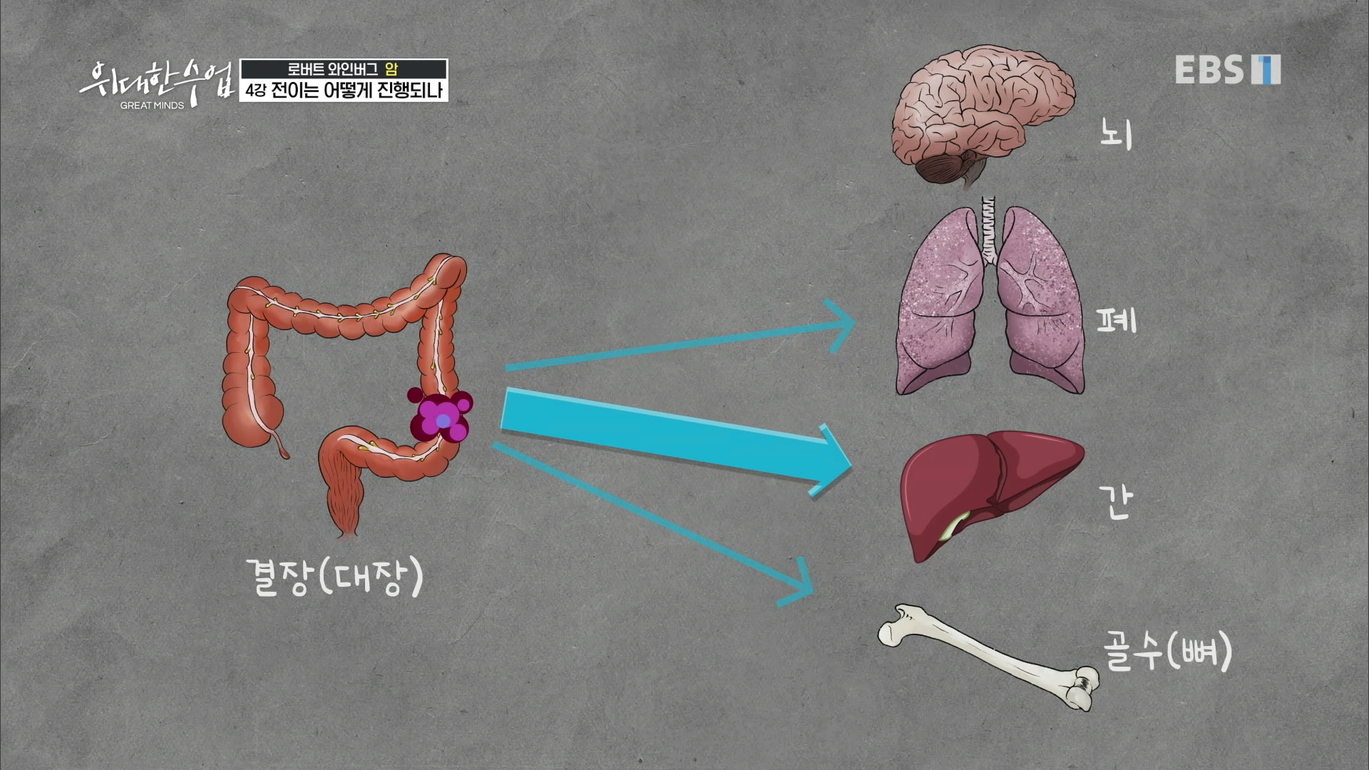 결장암 전이 기관