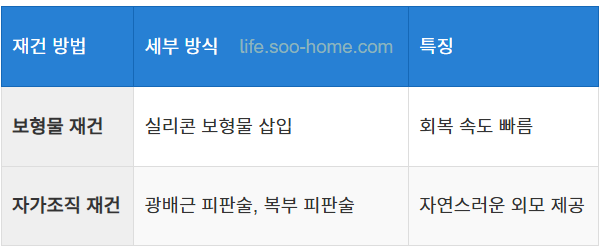 재건술의 방법