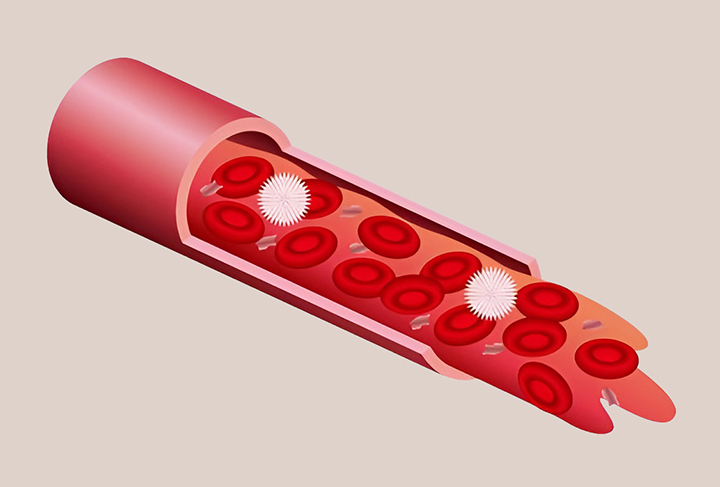 HDL콜레스테롤-모습