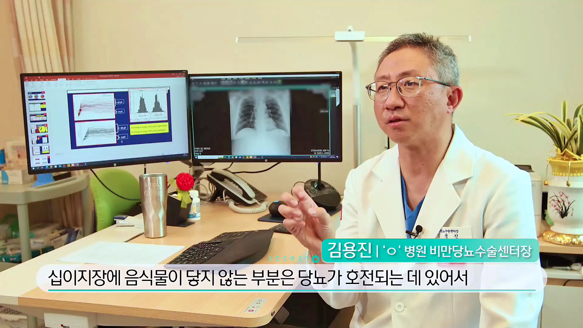 KBS 생로병사의 비밀 827회 최후의 다이어트 고도비만 위절제 수술, 위우회술 수술 차이점과 의료보험 대상 조건