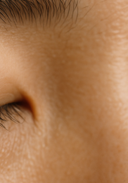 비립종 생기는 이유