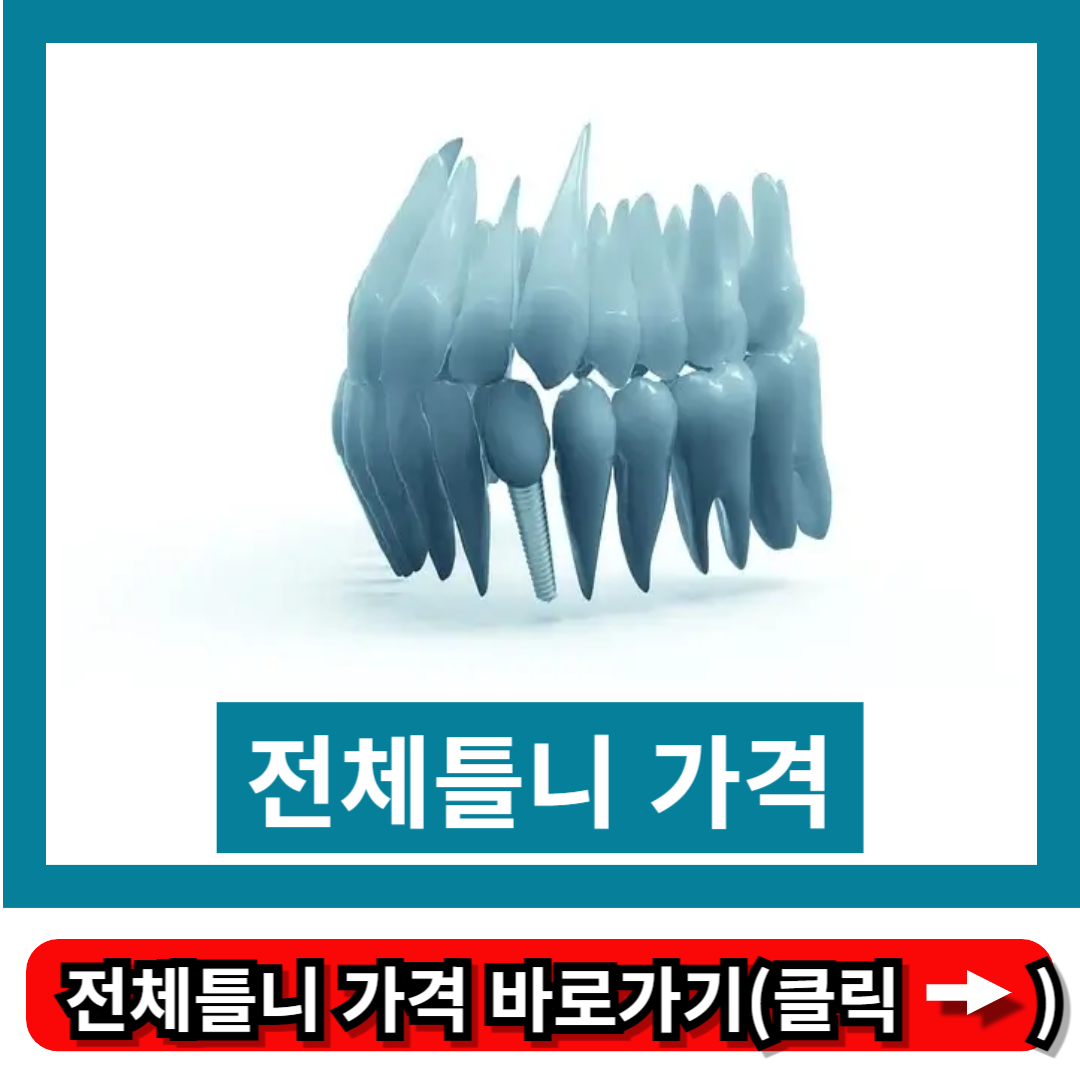 전체틀니 가격