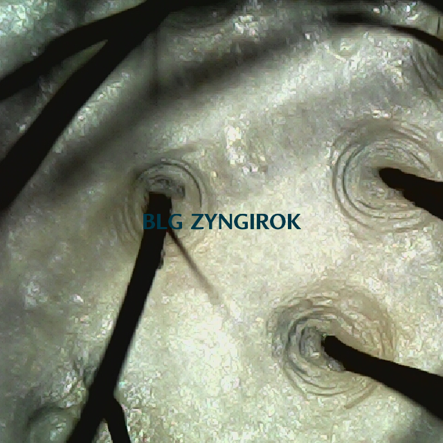 탈모 극복 프로젝트 - 정수리 두피 모습이다.