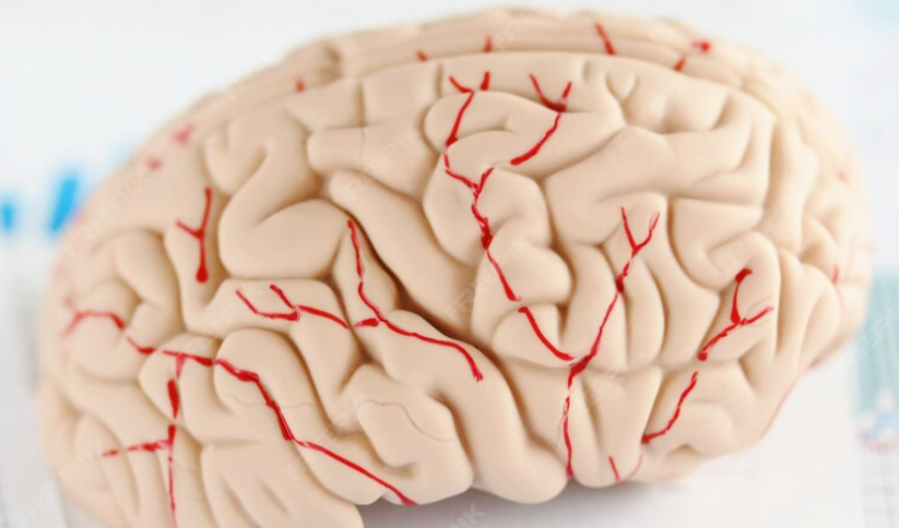 프랭크증후군-사진5