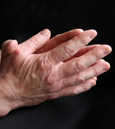 류마티스 관절염 초기증상 치료 원인 예방법