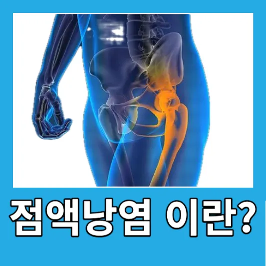 고관절 점액낭염