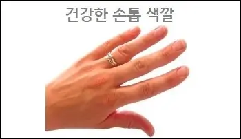 건강한 손톱 색깔