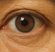 콜레스테롤 높으면 나타나는 증상