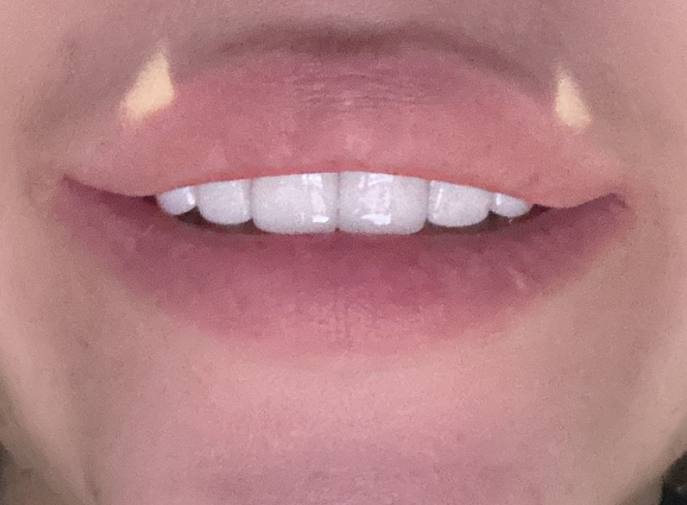 제로네이트 라미네이트 차이점