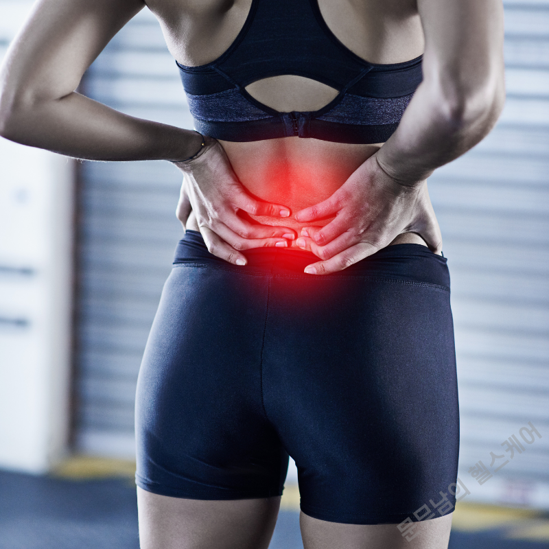 허리 삐끗했을 때, 요추 염좌 치료법