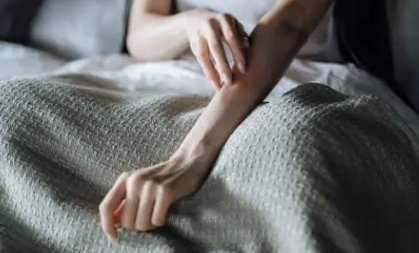 몸이 가려운 이유 9