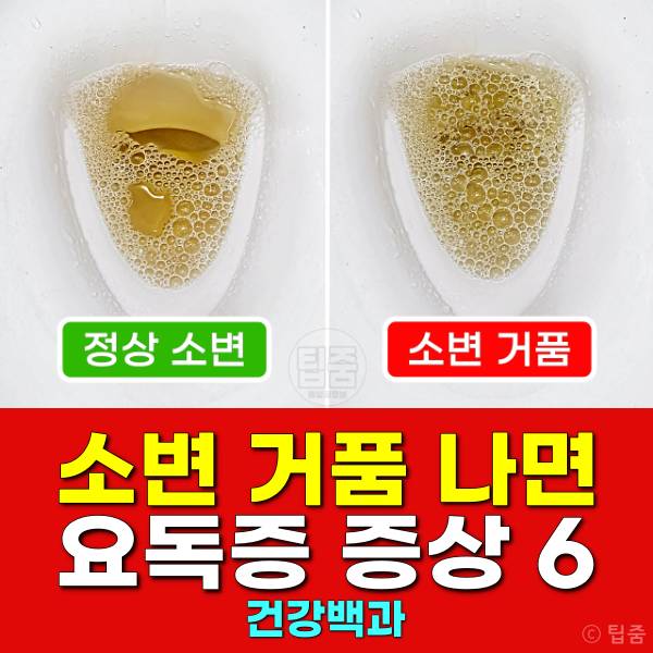 소변거품 어느정도 요독증 증상