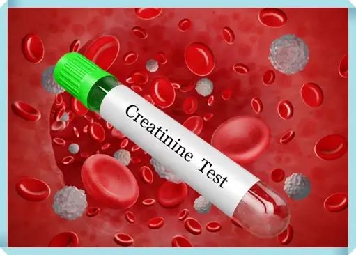 크레아티닌 수치가 높으면