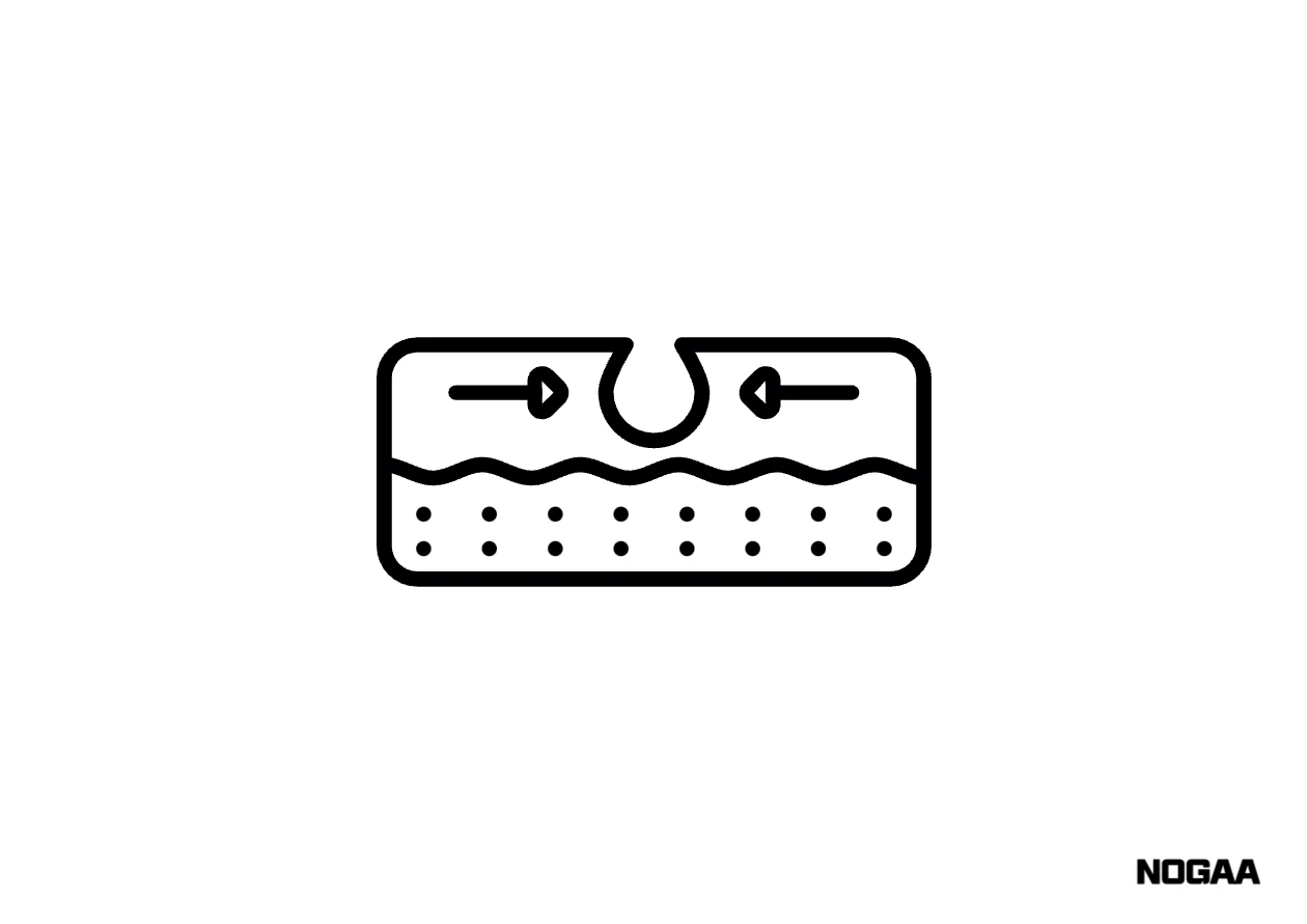 모공각화증 치료 방법