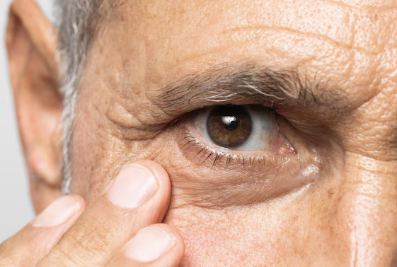 스테로이드 부작용 19