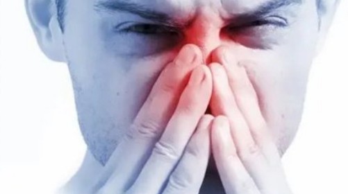 비염 증상, 원인, 치료방법, 영양제, 좋은음식, 비염약 부작용