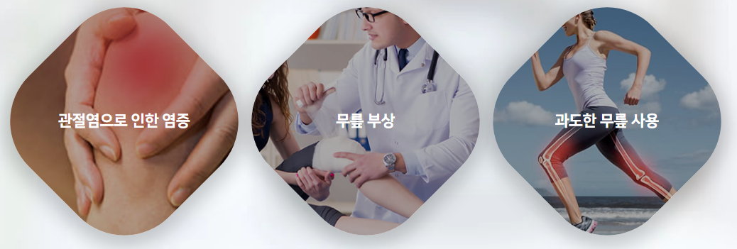 관절염-관절통증-다리염증-무릎부상에 좋은병원