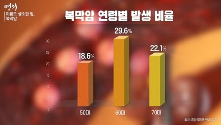 복막암연령별발생비율
