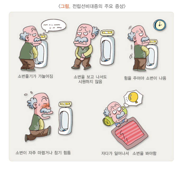 전립선비대증 주요 증상