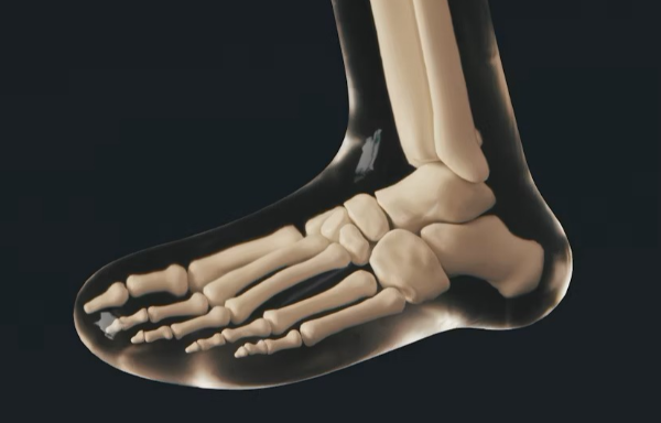 발바닥이 찌릿찌릿 아파요! 족저 근막염과 지간 신경종은 어떻게 다른가요?