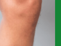 관절에좋은음식