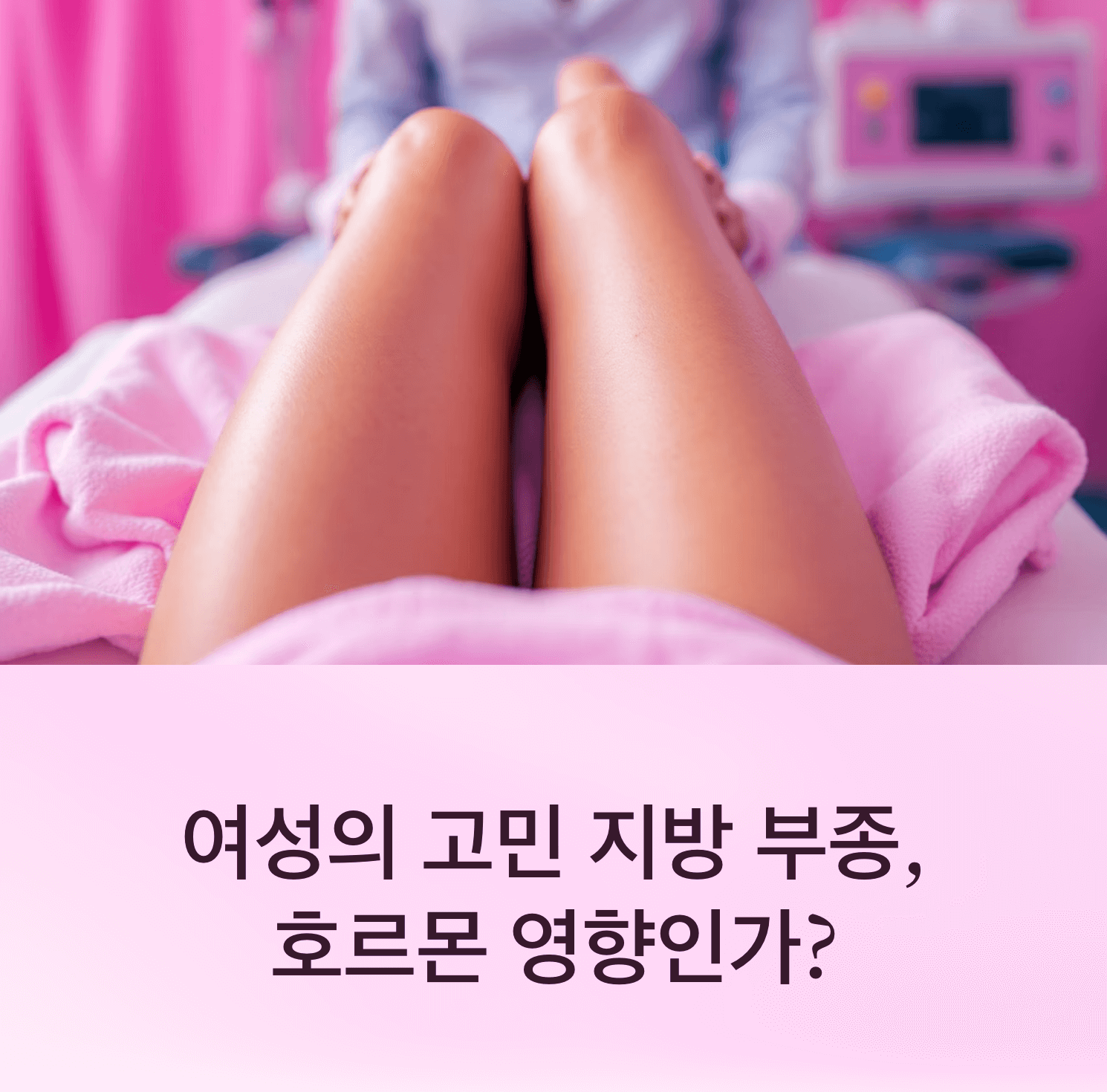 여자에게 흔한 지방 부종, 호르몬 영향인가?