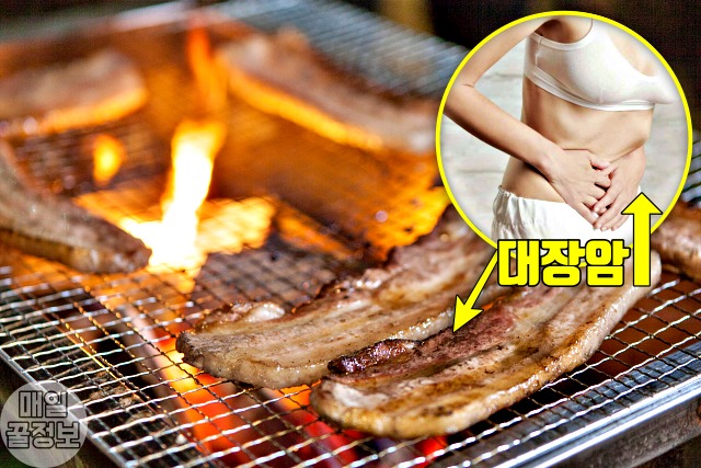 암이 좋아하는 음식,탄 고기 암유발 음식