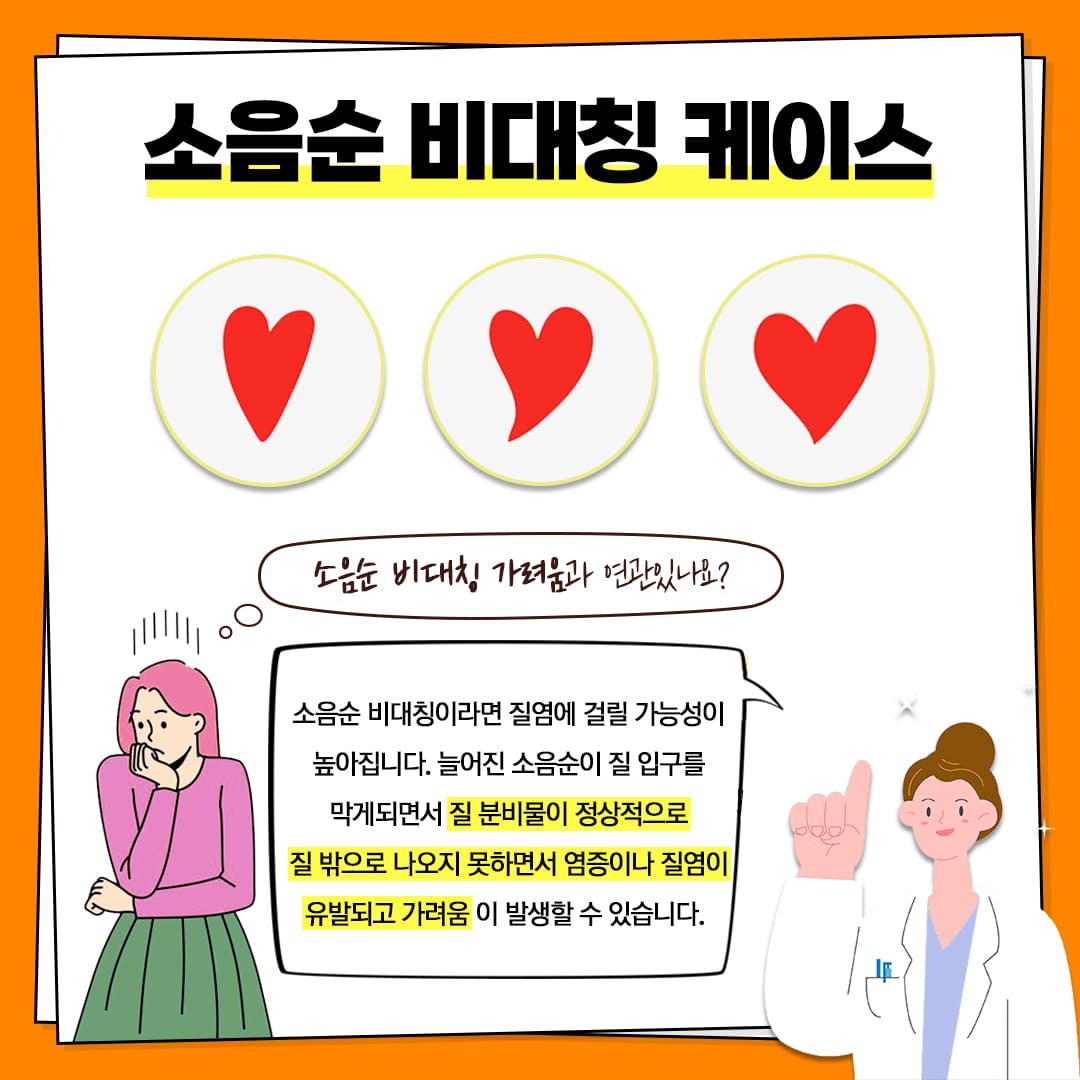 소음순 비대칭 다양한 케이스!