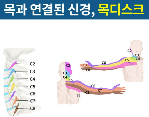 팔저림 원인
