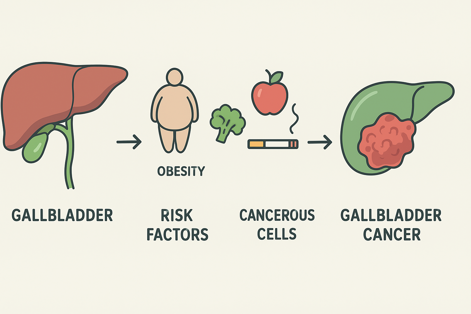 담낭암 관련 사진