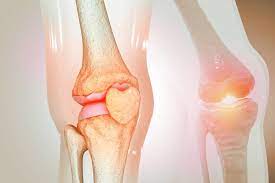 머위 효능 5가지 부작용 머위 데치기는 방법 양념장 뿌리 머위잎 머위즙