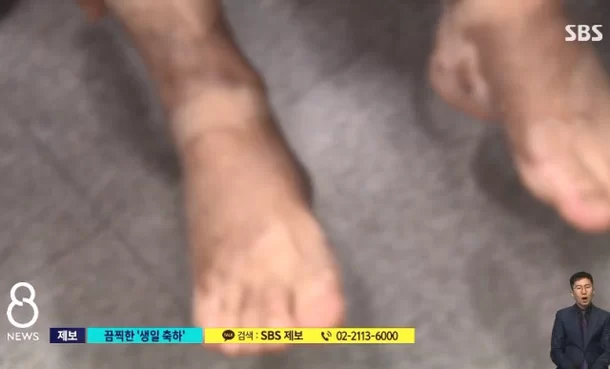 생일 축하한다며 친구에게 휘발유 뿌리고 폭죽 터트린 친구들