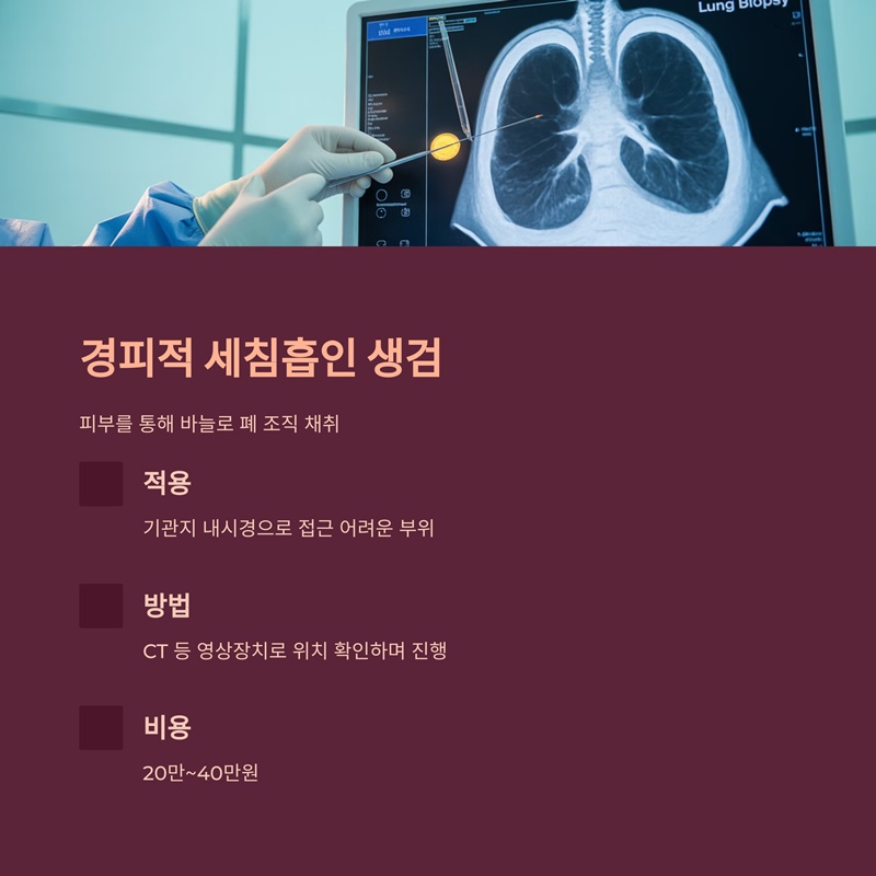 경피적 세침흡인 생검