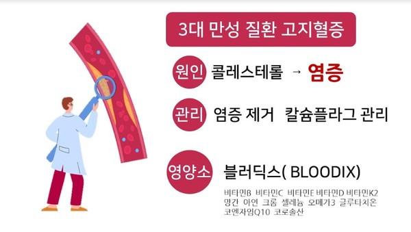 고지혈증 치료법