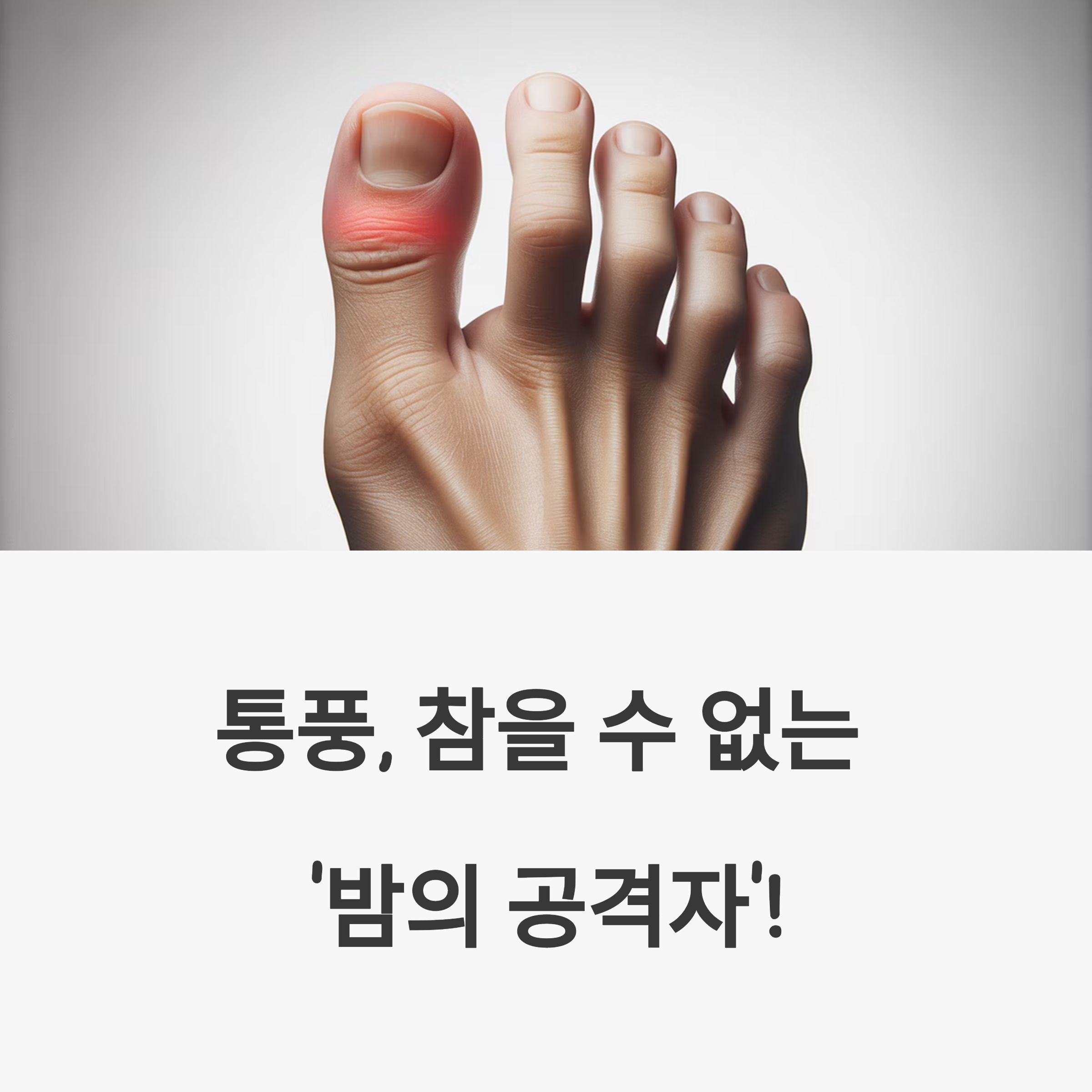 통풍