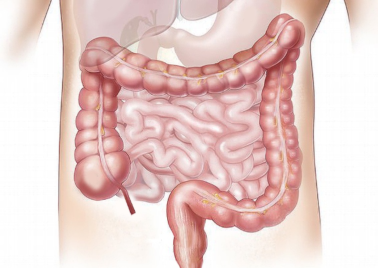 암이 생기는 진짜 이유? 면역력이 무너졌기 때문입니다