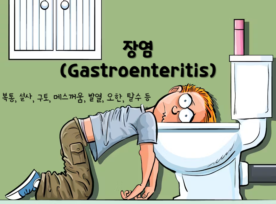 장염(Gastroenteritis)
장염의 일반적인 증상 : 복통, 설사, 구토, 메스꺼움, 발열, 오한, 탈수 등