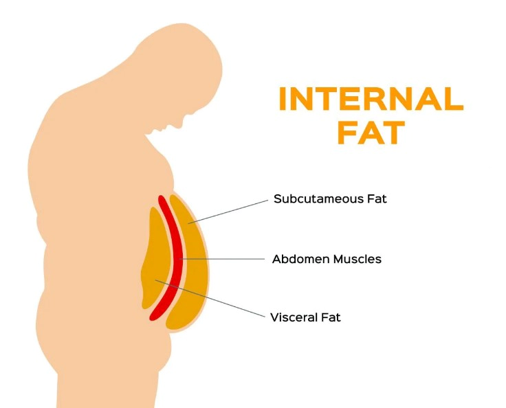 복부 지방 제거에 좋은 운동