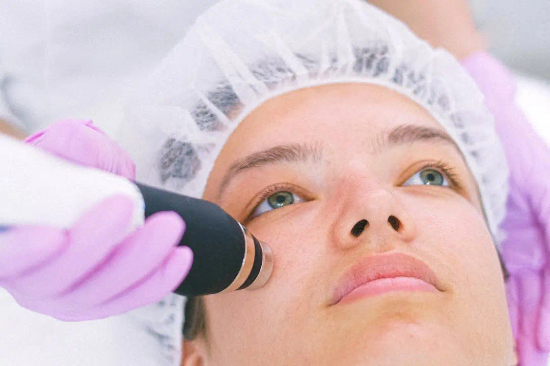 레이저 치료를 받고있는 기미있는 여성1