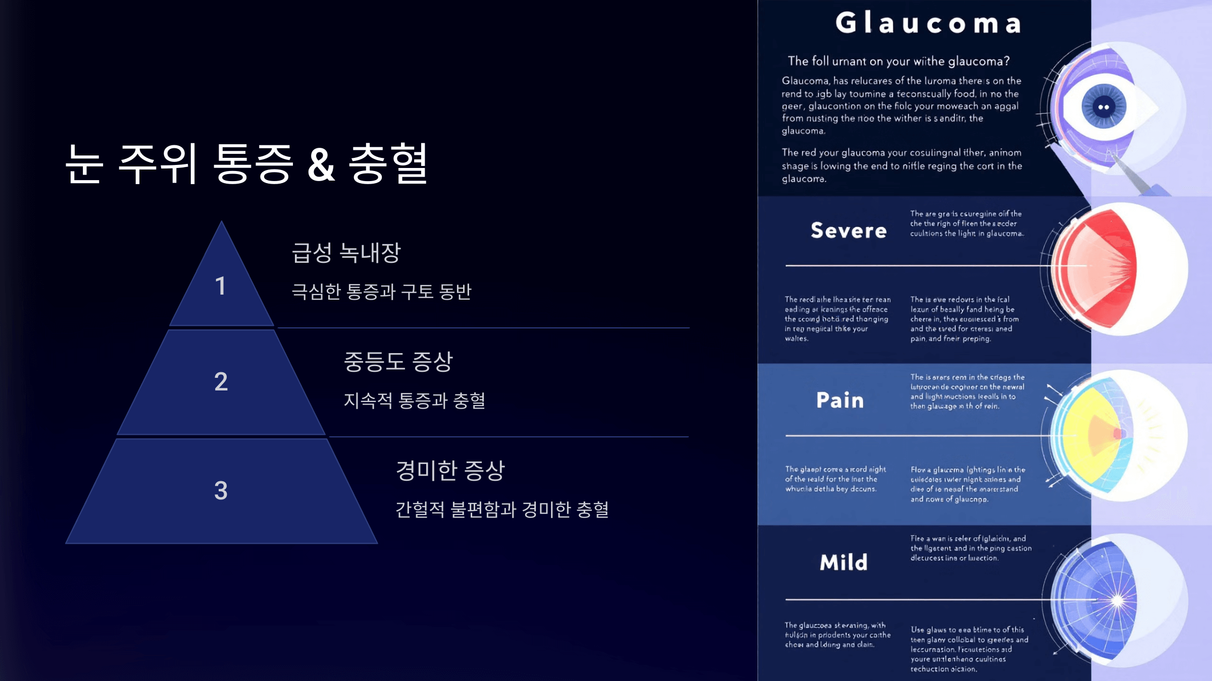 녹내장과 관련된 사진입니다.