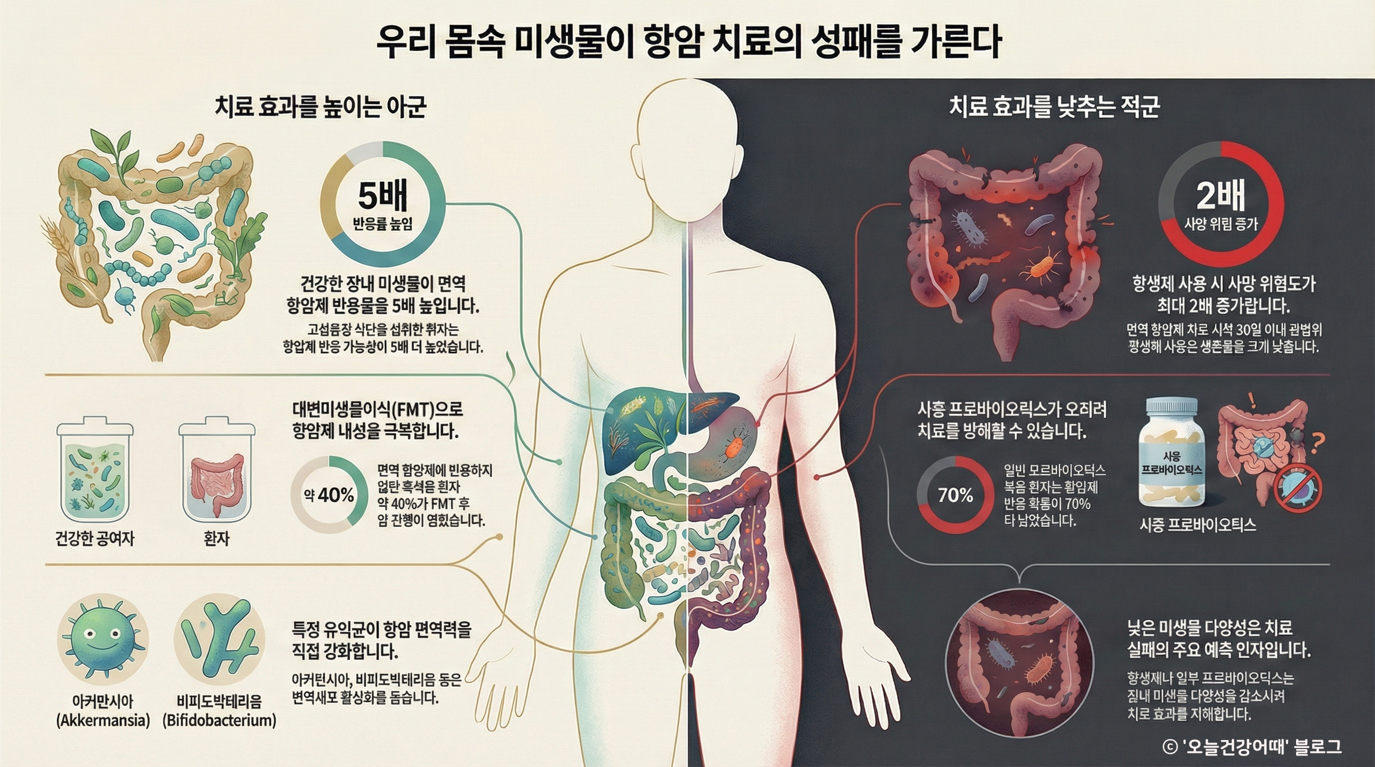 마이크로바이옴, 장내미생물, 4세대항암제, 유산균, 유익균, 아커만시아, 비피도박테리움