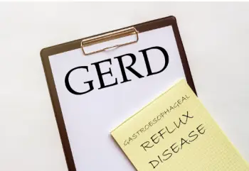 역류성 식도염 원인 및 증상, 치료법