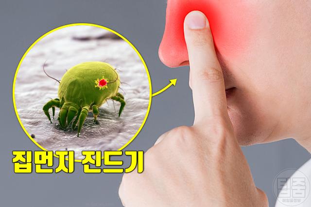 만성 코막힘 원인 알레르기