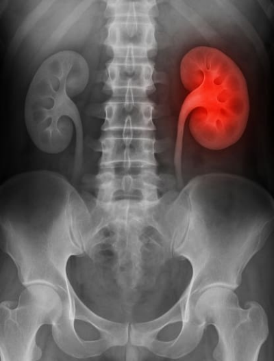 신우신염 증상과 원인