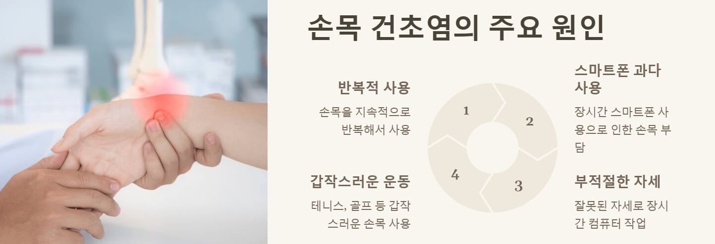 손목 건초염 증상 치료
