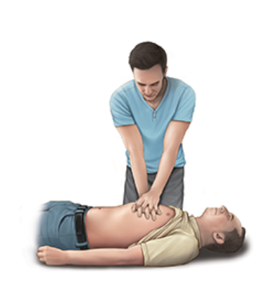 심폐소생술순서방법