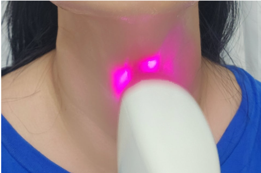 바디닥터 고주파 리페어 리뷰