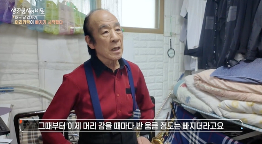 원형탈모이미지
