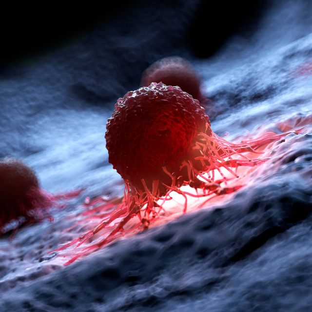 락토페린_암세포 